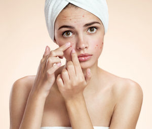 Acne Dermatology Procedures