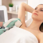 Woman receiving laser hair removal treatment on her underarm.