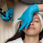 Woman receiving hydrafacial treatment